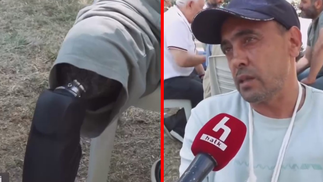 Gazilerin kafaları öne eğdiren “Protez” çilesi! Bu sözler boğaz düğümledi